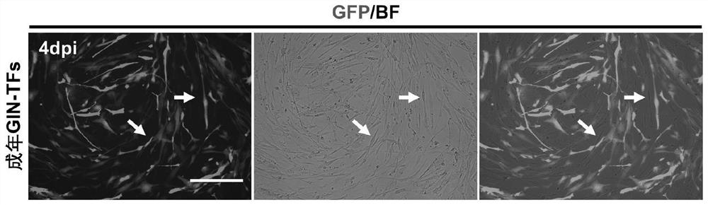 Method for preparing inhibitory interneurons capable of retaining age characteristics from non-nerve cell transformation