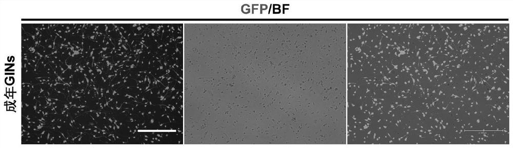 Method for preparing inhibitory interneurons capable of retaining age characteristics from non-nerve cell transformation