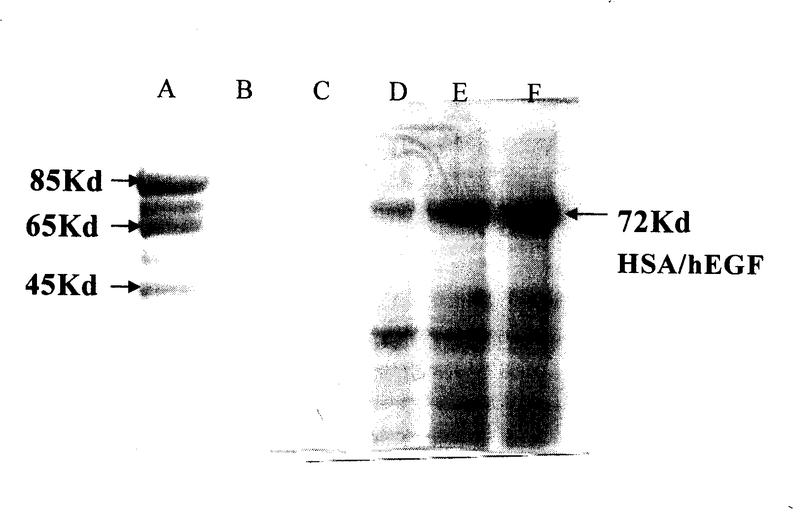 Technique for preparing amalgamation protein skin-protection product containing albuminar and skin cell growth factor, and uses of the same