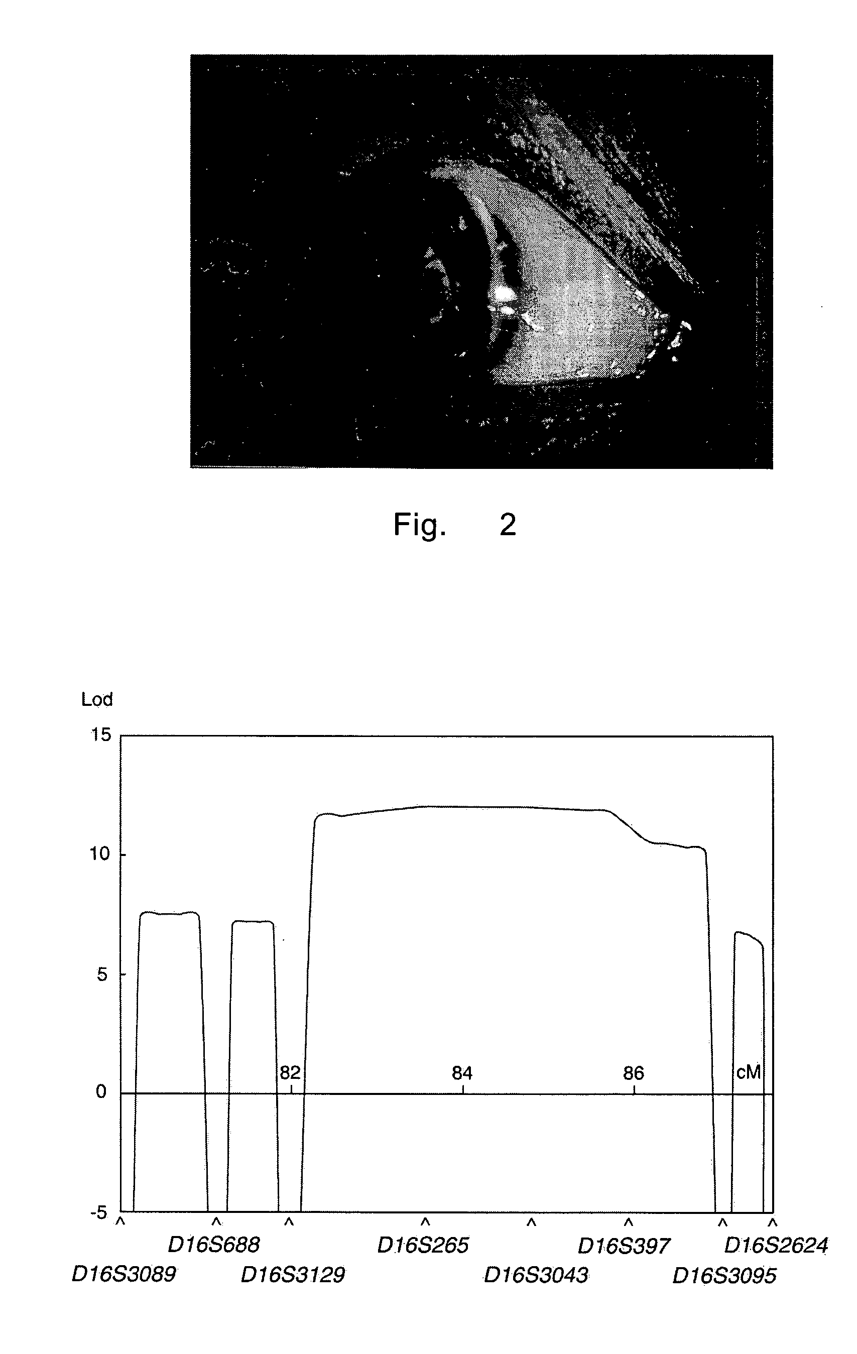 Method of diagnosing and treating lens illnesses using human HSF4 gene and coded product thereof