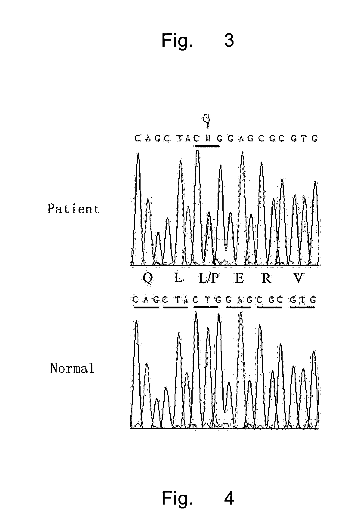 Method of diagnosing and treating lens illnesses using human HSF4 gene and coded product thereof