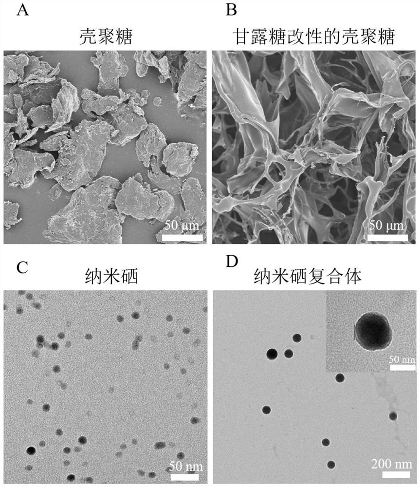 Selenium nano composite material capable of overcoming multi-drug-resistant bacterial infection, preparation method and application thereof