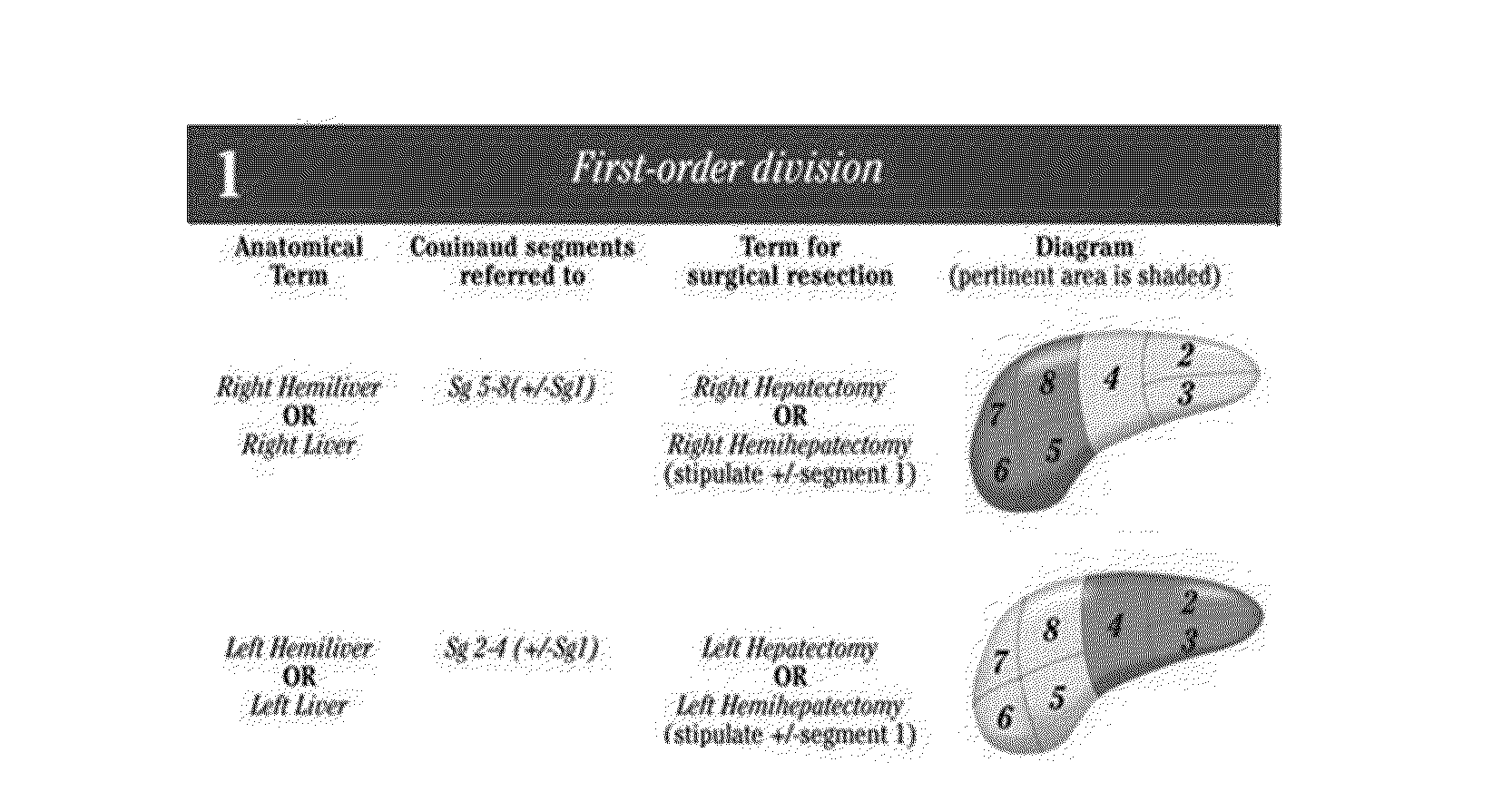 Ct atlas of the brisbane 2000 system of liver anatomy for radiation oncologists