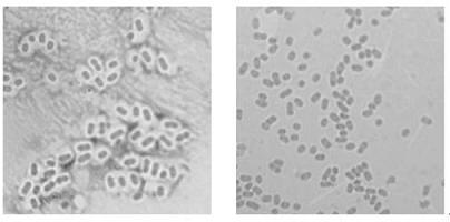 Bacteriophage depolymerase capable of degrading Klebsiella pneumoniae capsular polysaccharides and biofilms