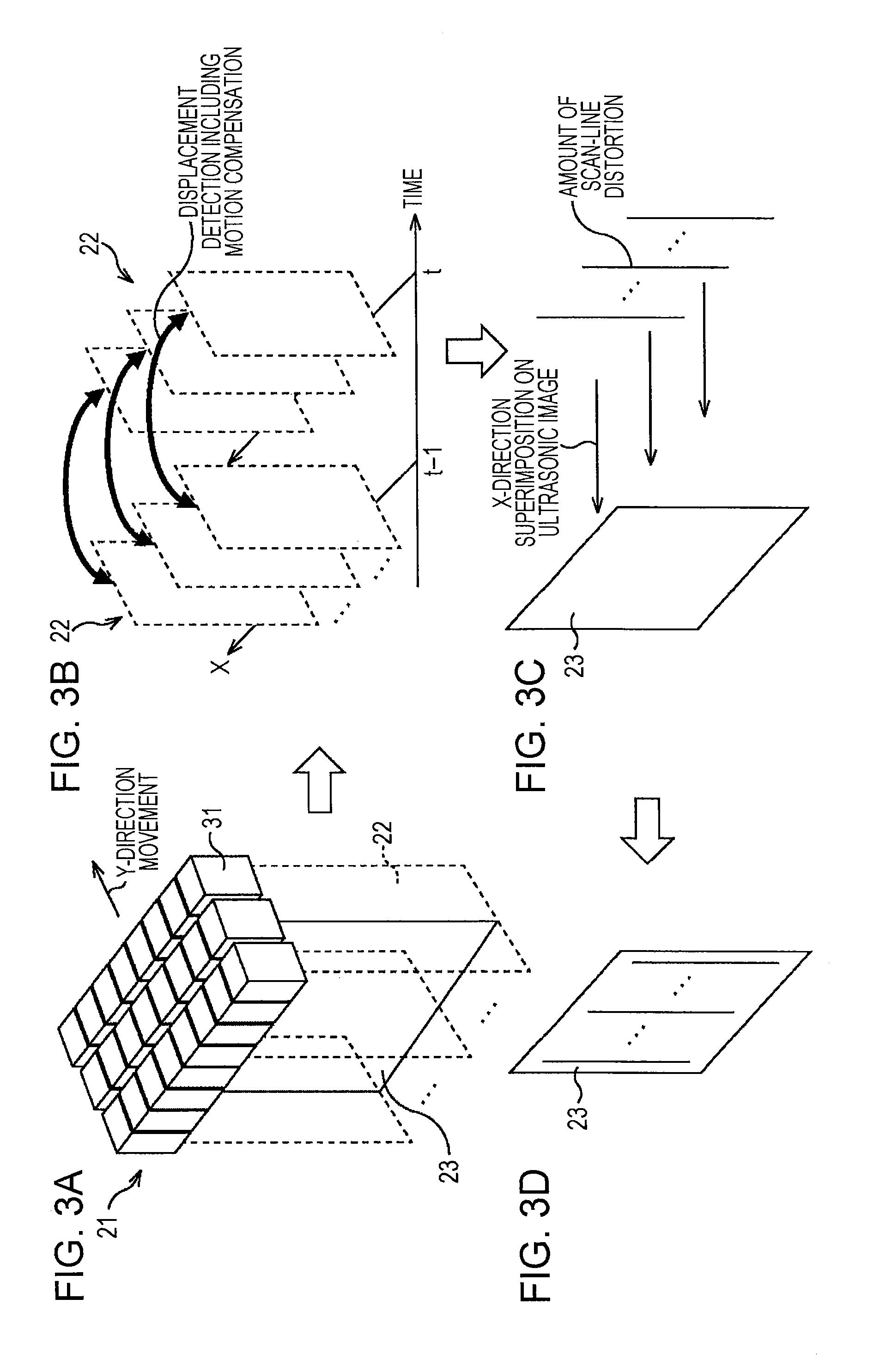 Image processing apparatus and method, and ultrasonic diagnostic apparatus