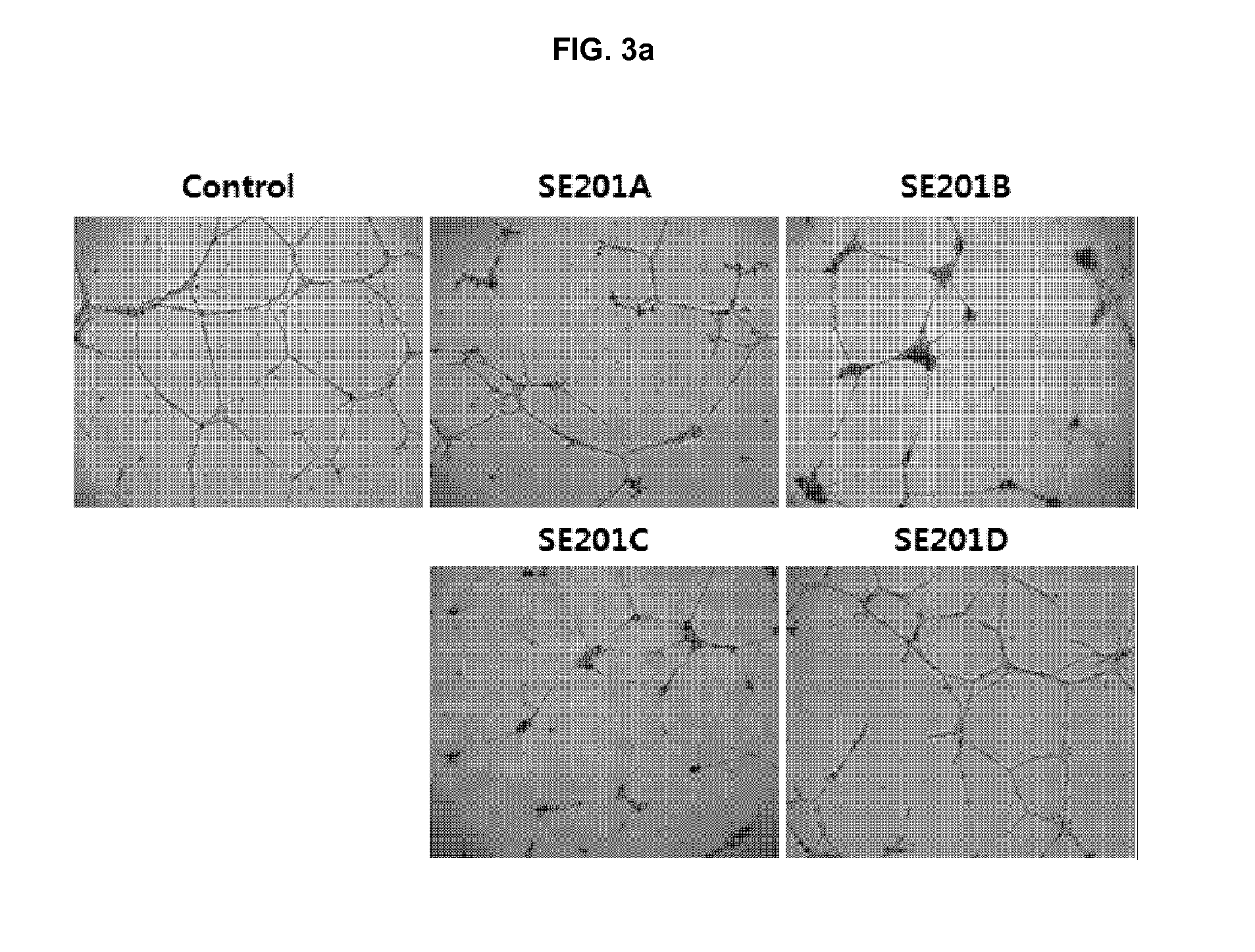 Peptides having NF-κB inhibitory activity, or composition comprising same