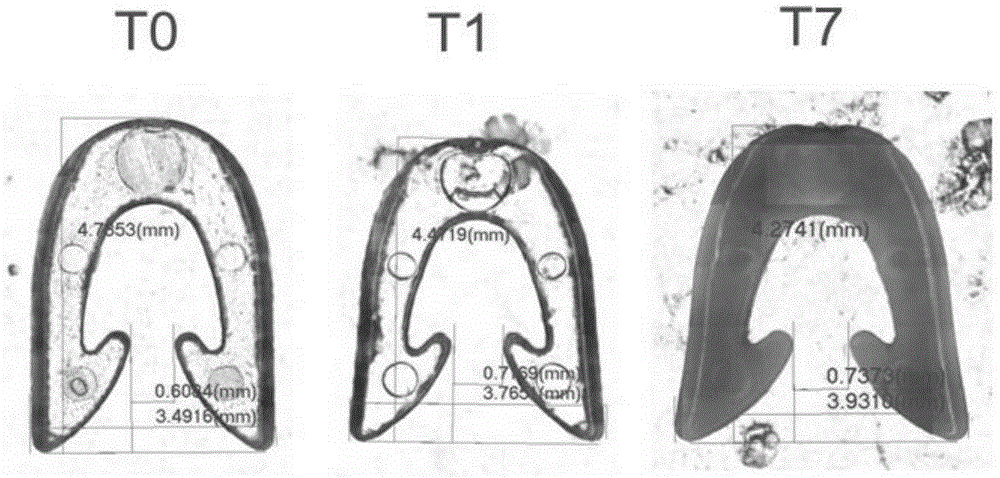 An absorbable skin suture staple and its preparation method