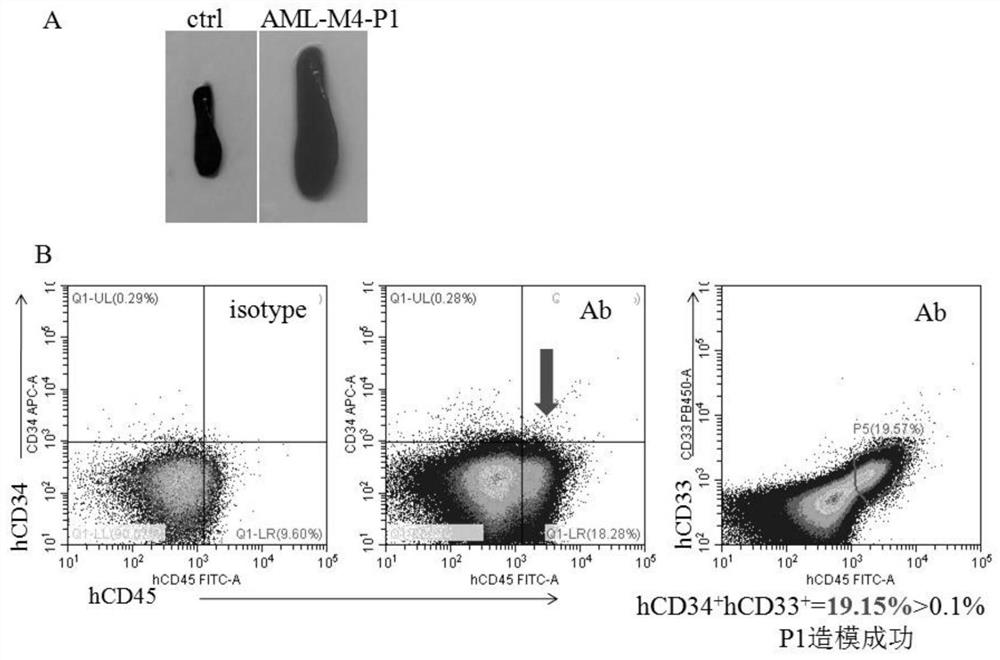 A PDX model establishment method of granulocytic tumor