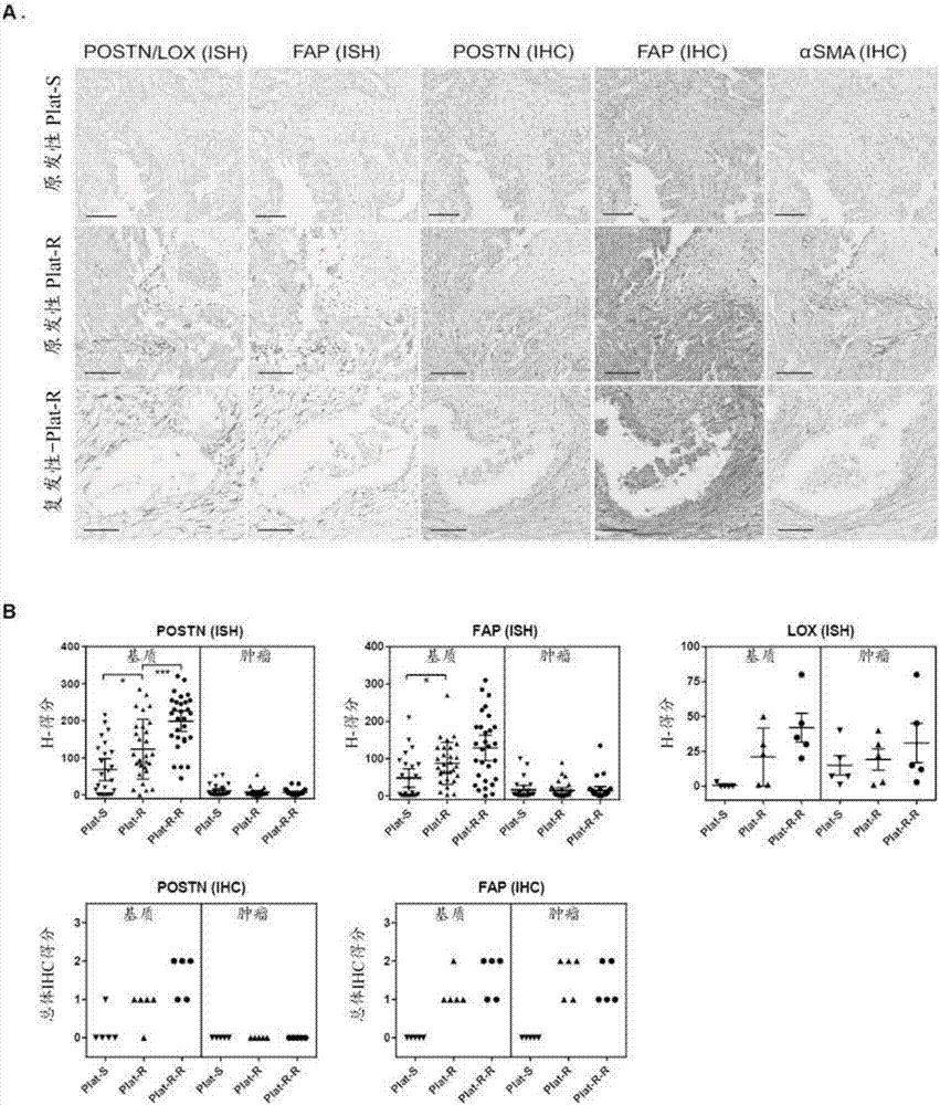 Compositions and methods for treating and diagnosing chemotherapy-resistant cancers
