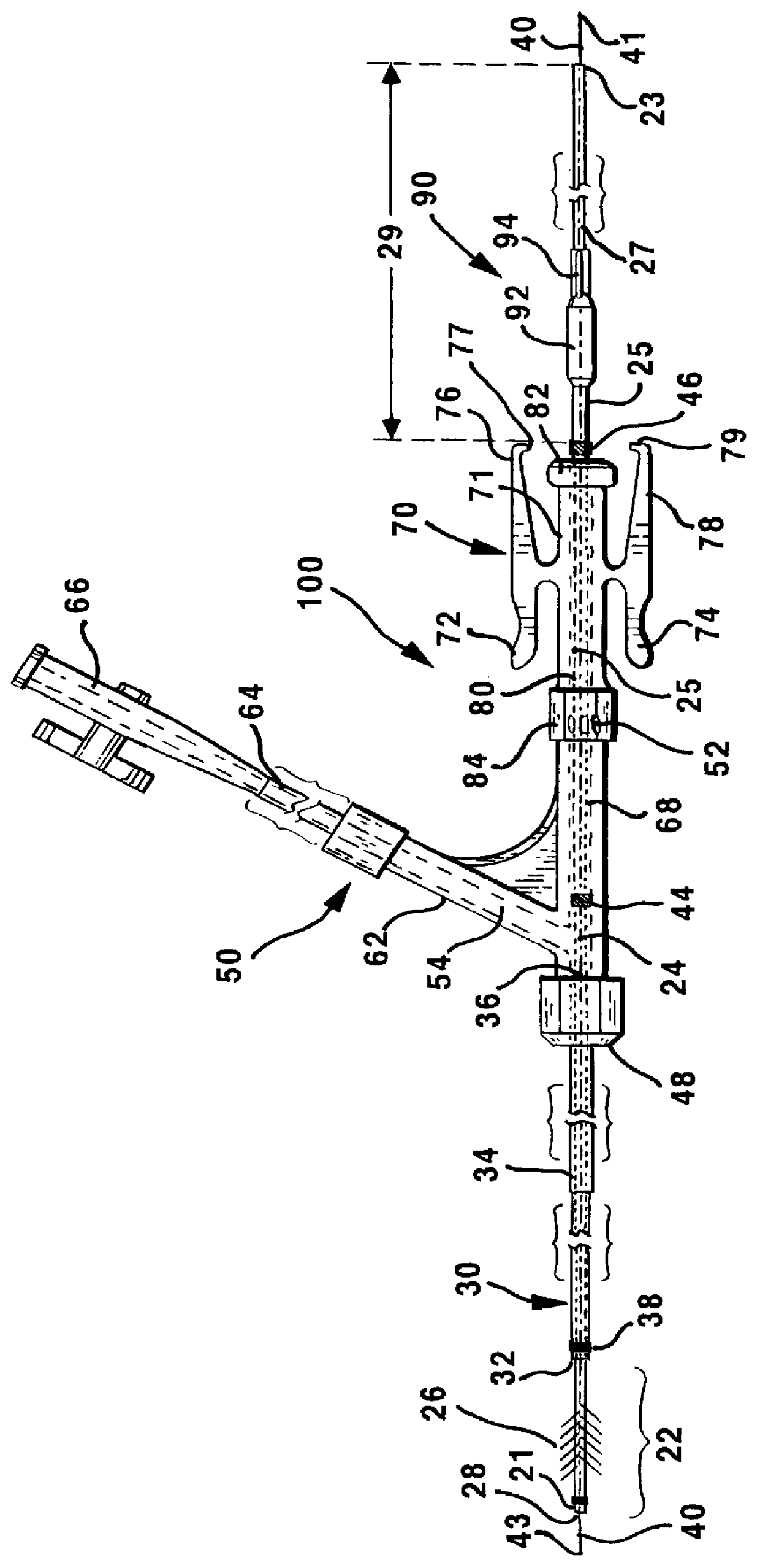 Rotatable attachment mechanism for attaching a medical obstruction treatment device sub-assembly to a drive motor unit