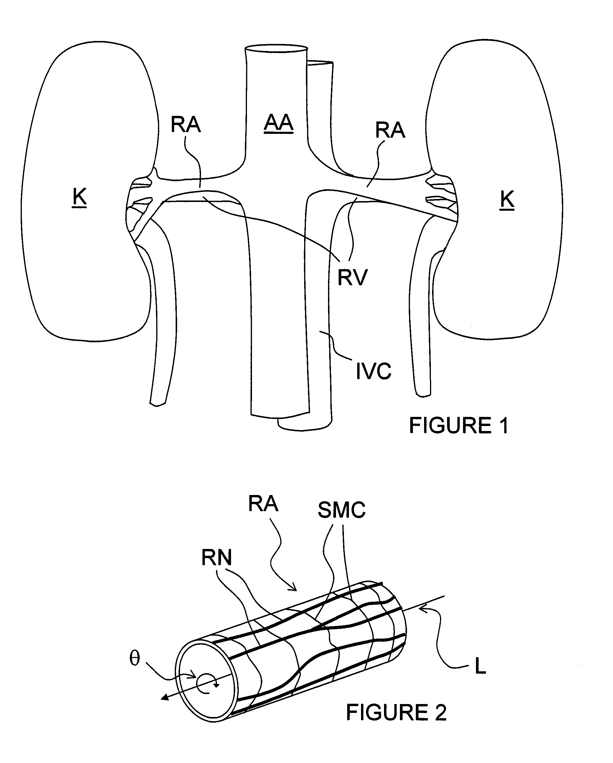 Methods for thermally-induced renal neuromodulation