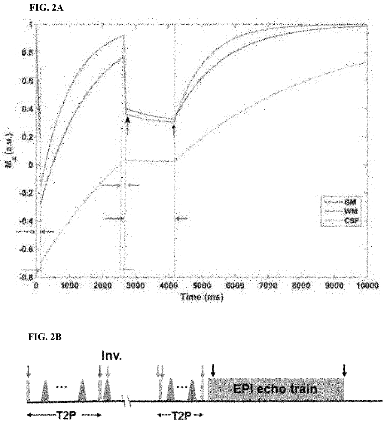 High-resolution cerebrospinal fluid-suppressed t2*-weighted magnetic resonance imaging of cortical lesions