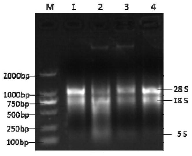 A method for removing apple virus by ultra-low temperature vitrification of shoot tips