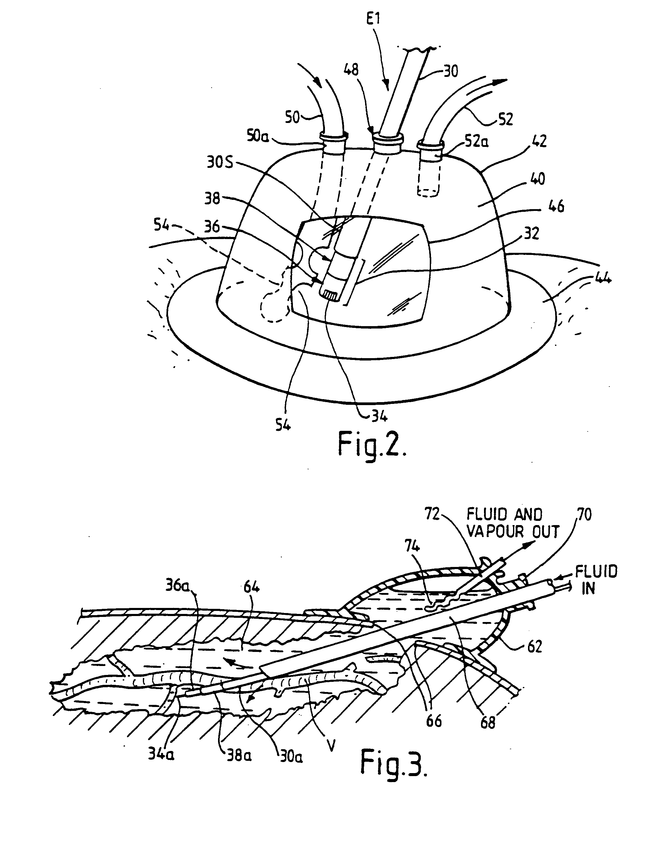Electrosurgical system and method