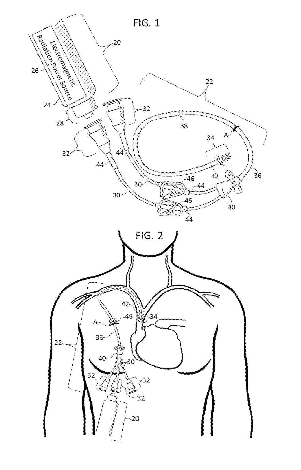 Methods and apparatus to inactivate infectious agents on a catheter residing in a body cavity