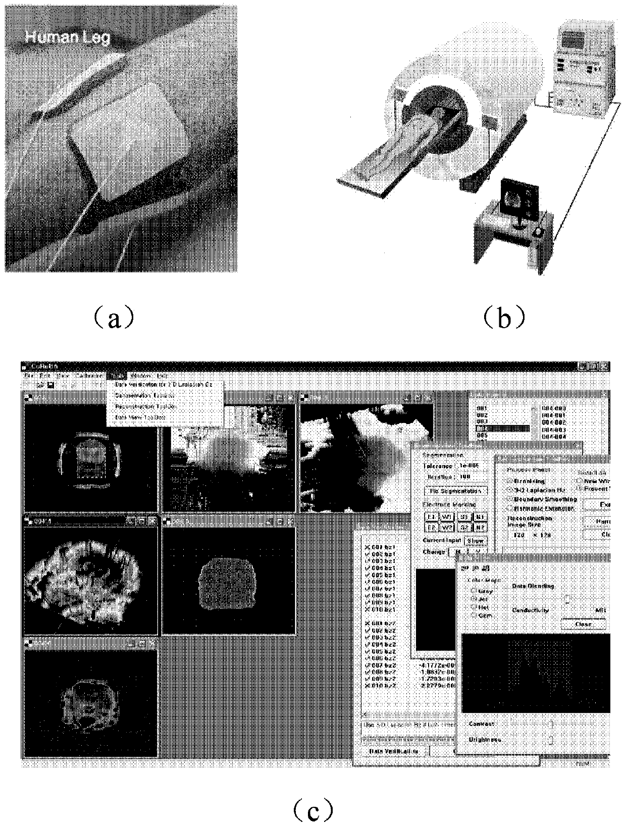 Microcosmic electrical impedance imaging device and method based on diamond NV color center