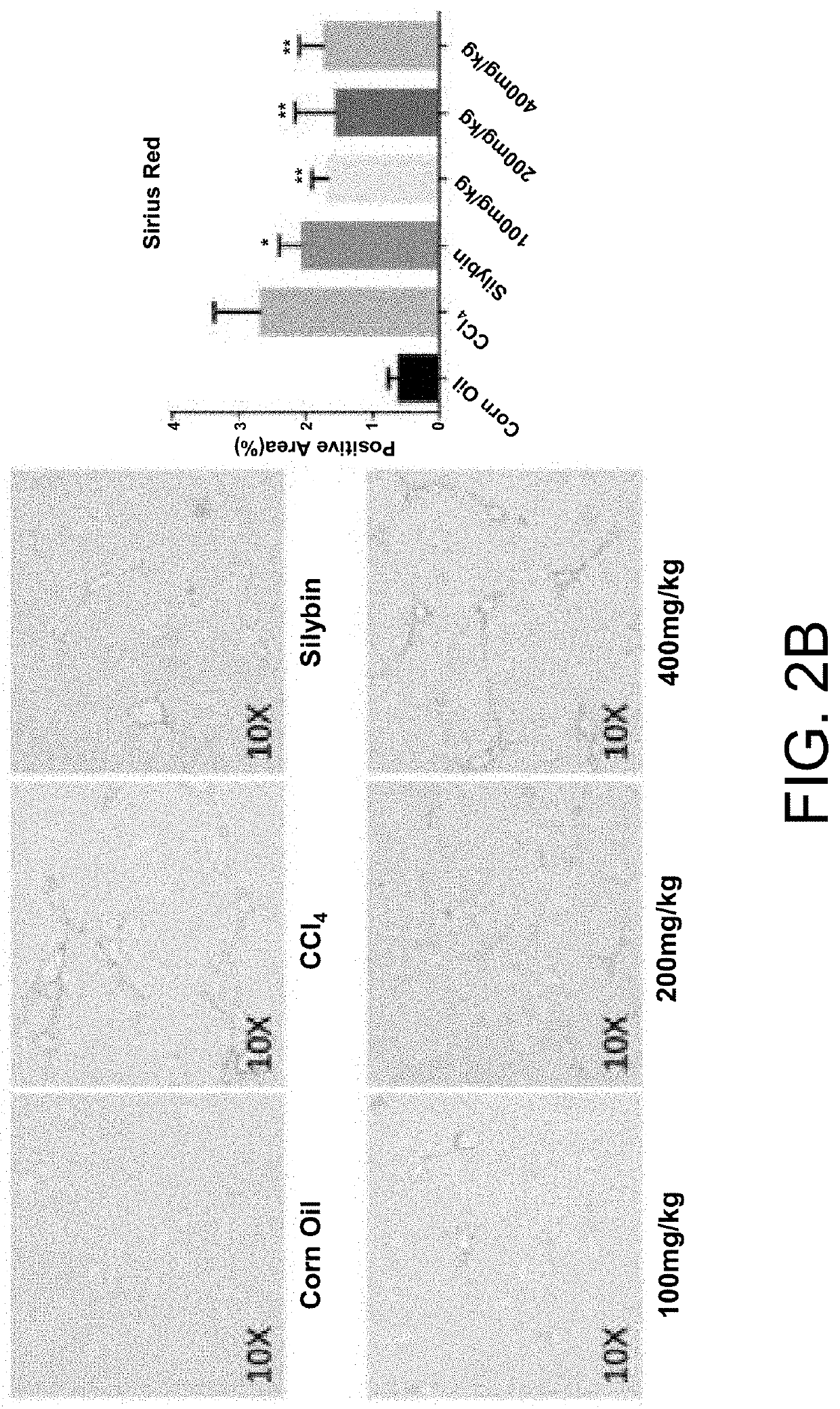 Application of longhu rendan in preparing medicament for preventing and/or treating liver fibrosis