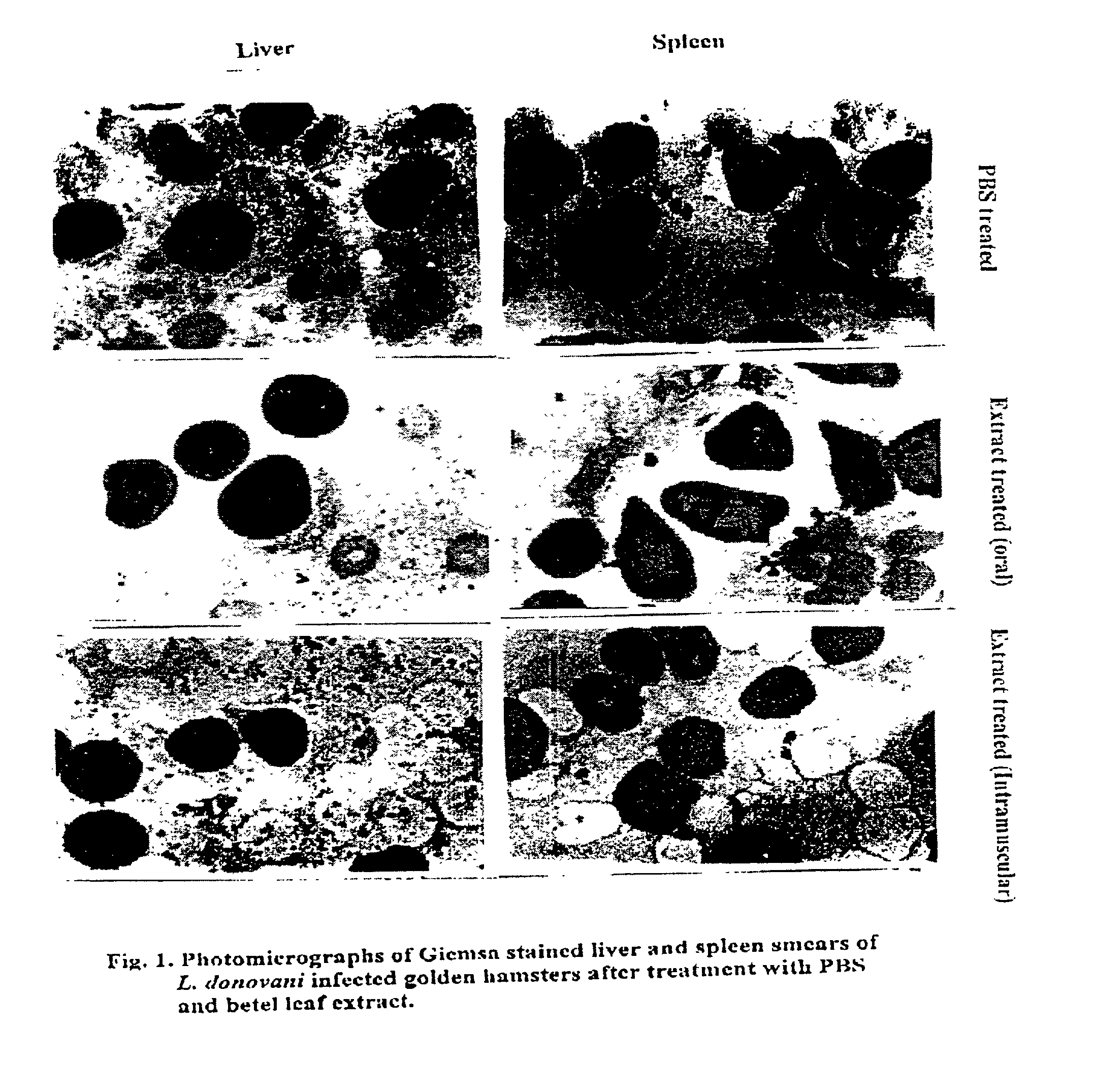 Anti-leishmanial activity of betel leaf extract