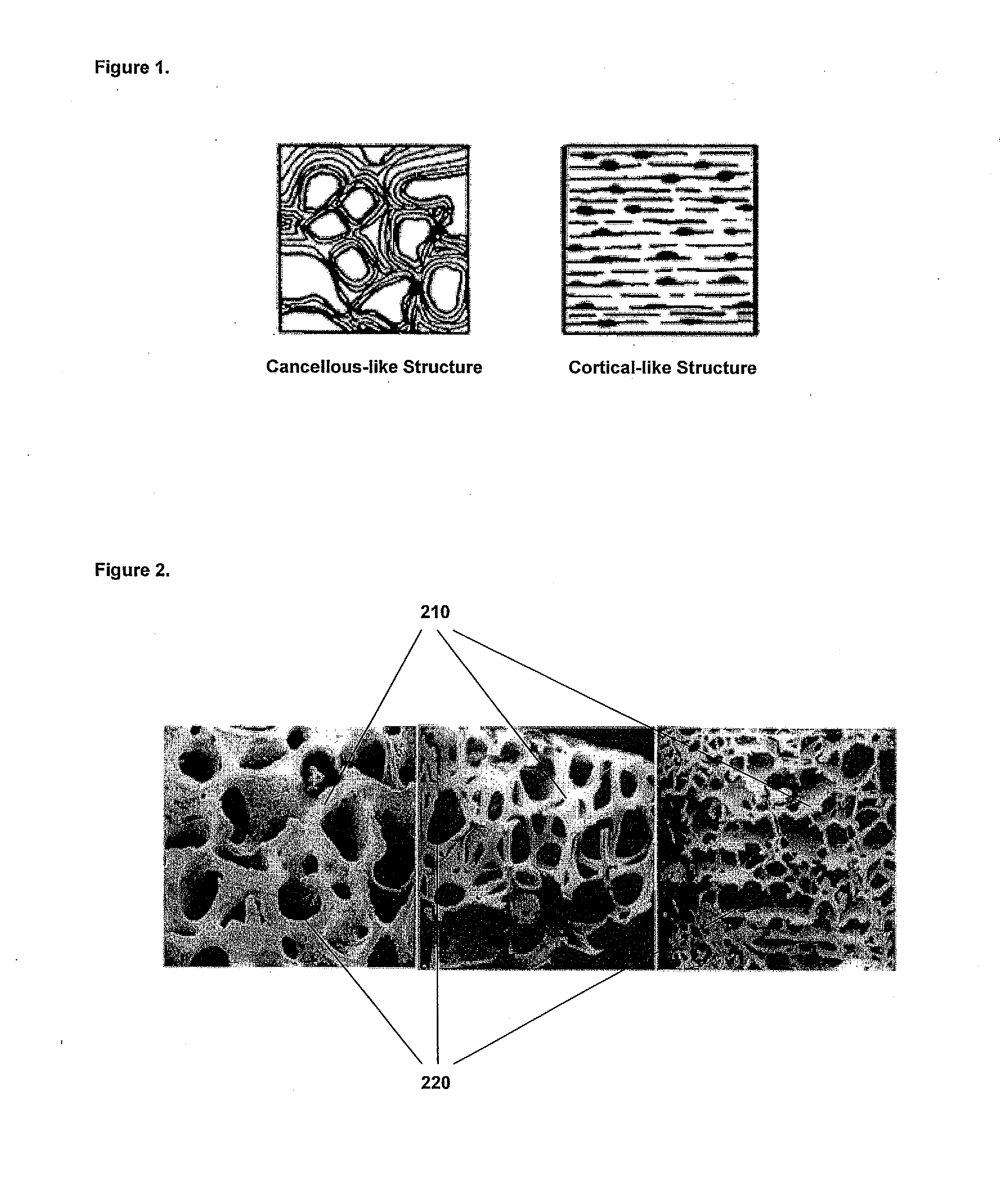 Methods and compositions for fusing bone during endoscopy procedures