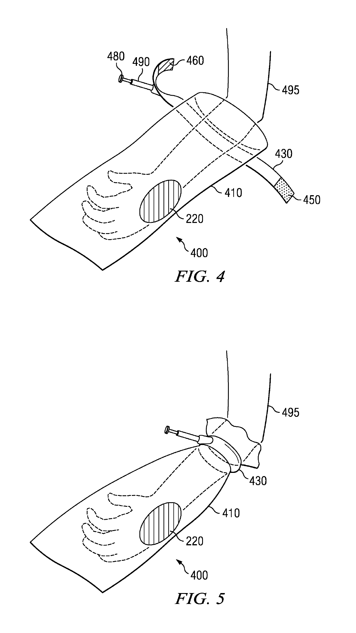 Apparatus and method for deploying a surgical preparation