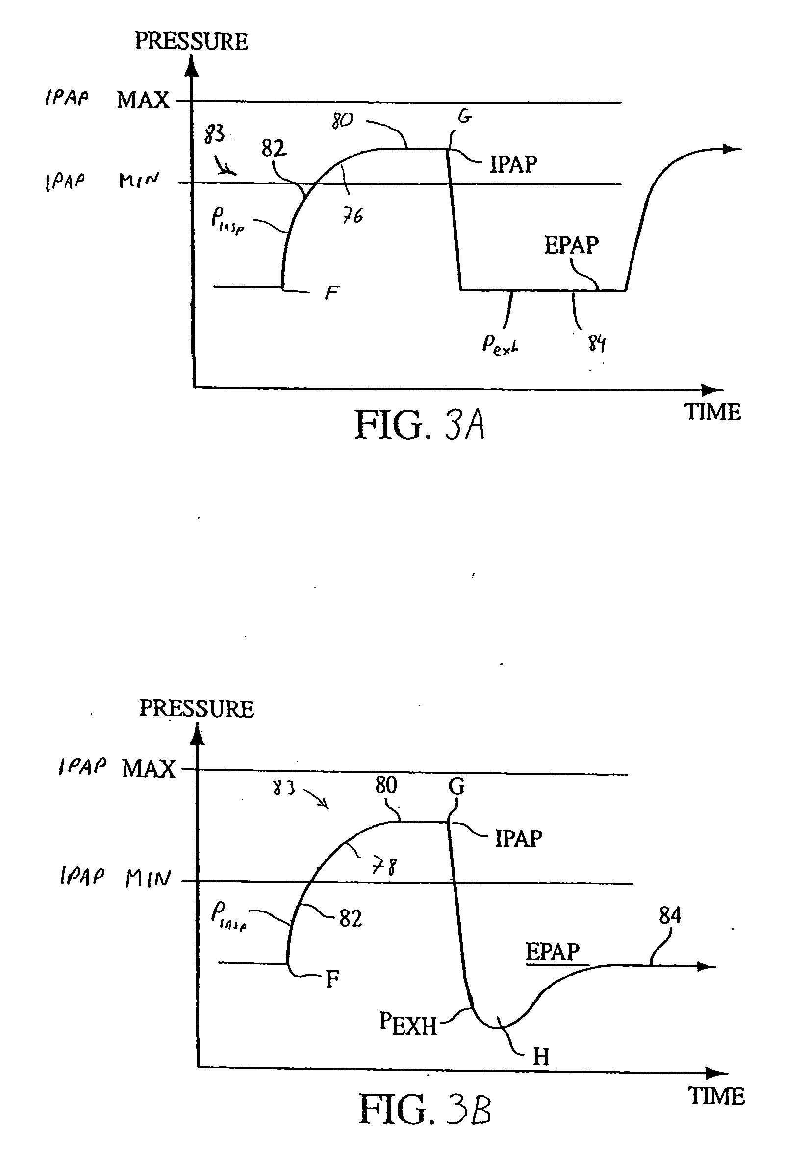 Method and apparatus for treating cheyne-stokes respiration