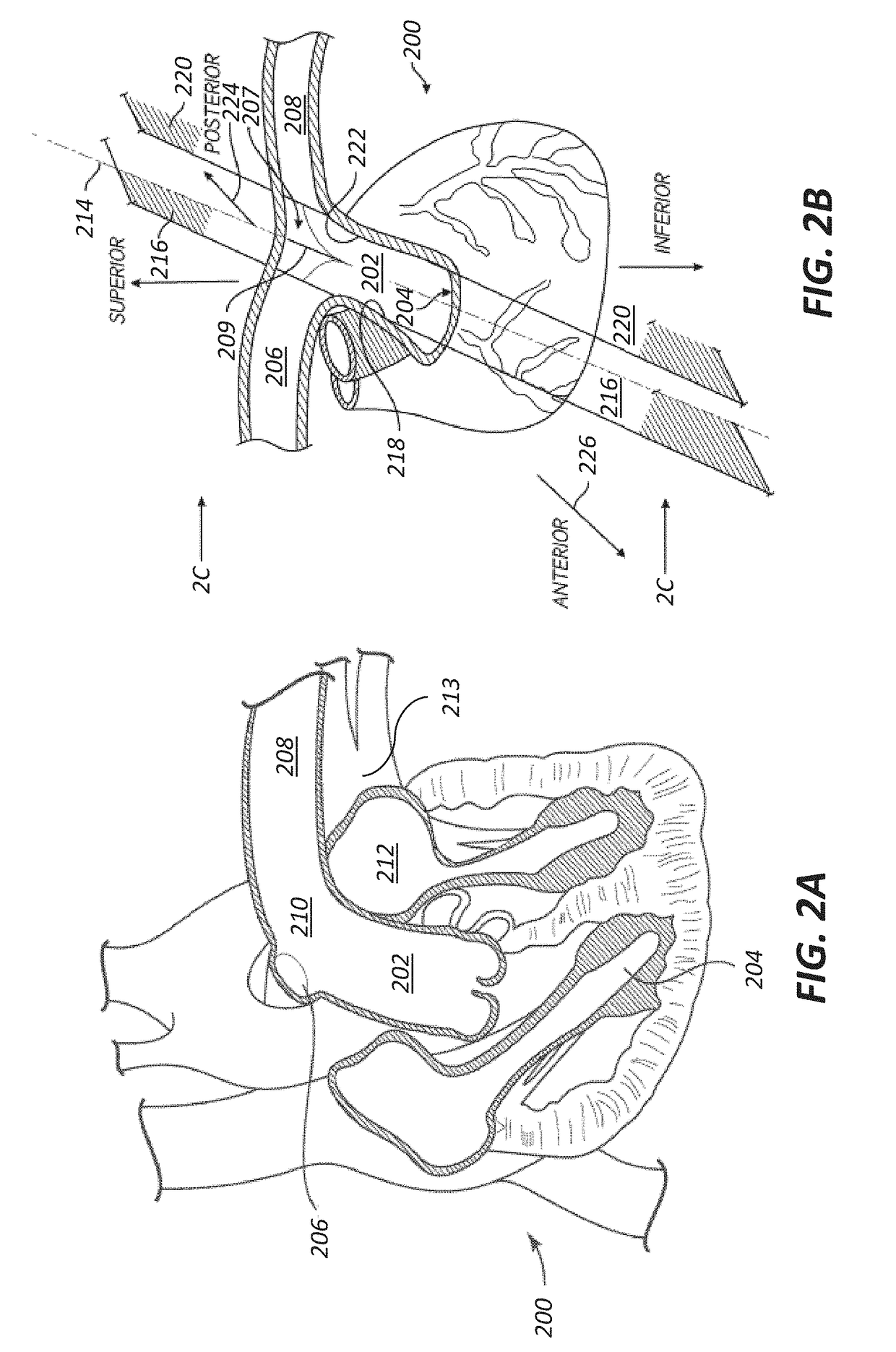 Methods of facilitating positioning of electrodes