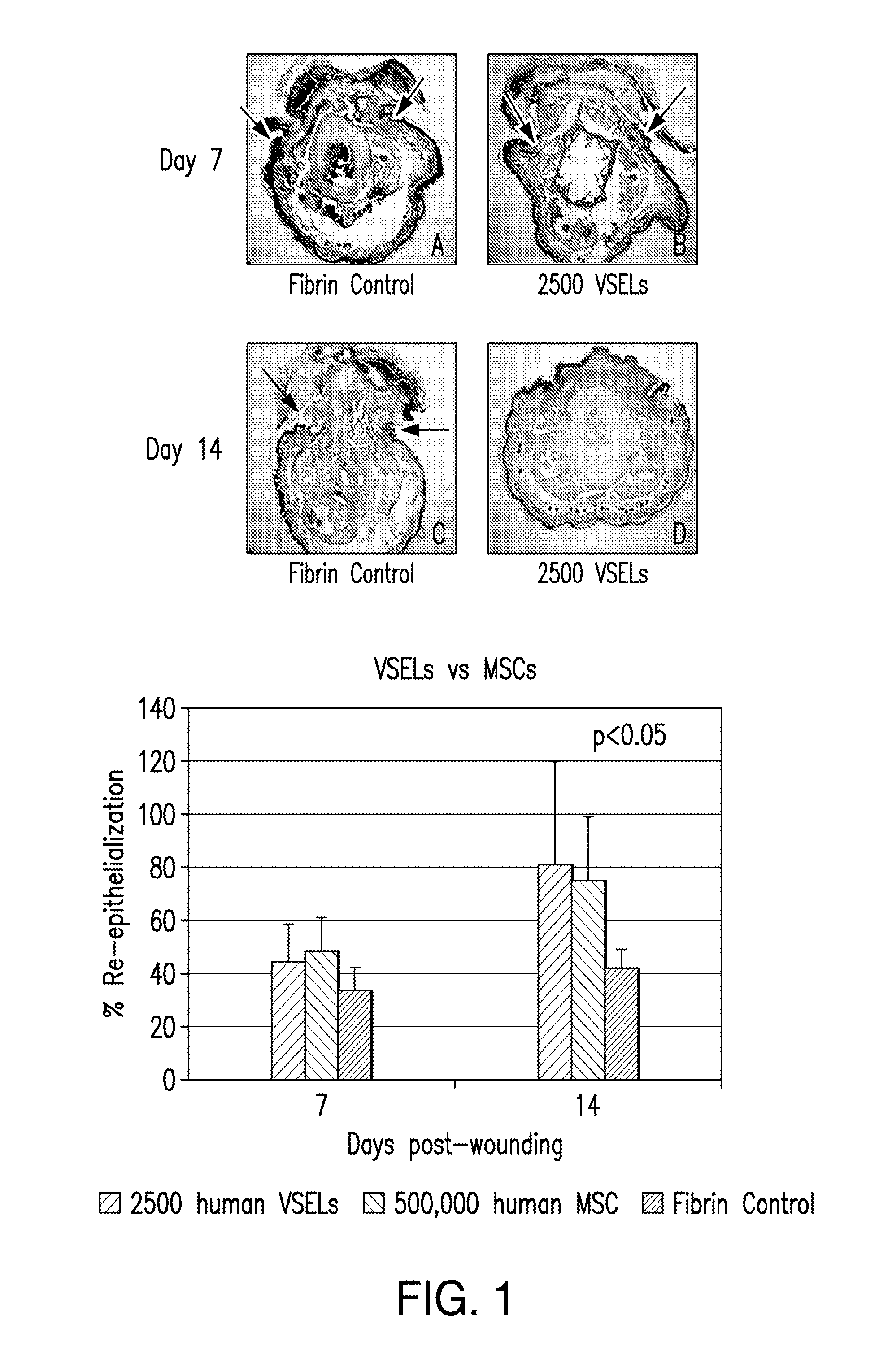 Stem cell compositions and methods for would healing
