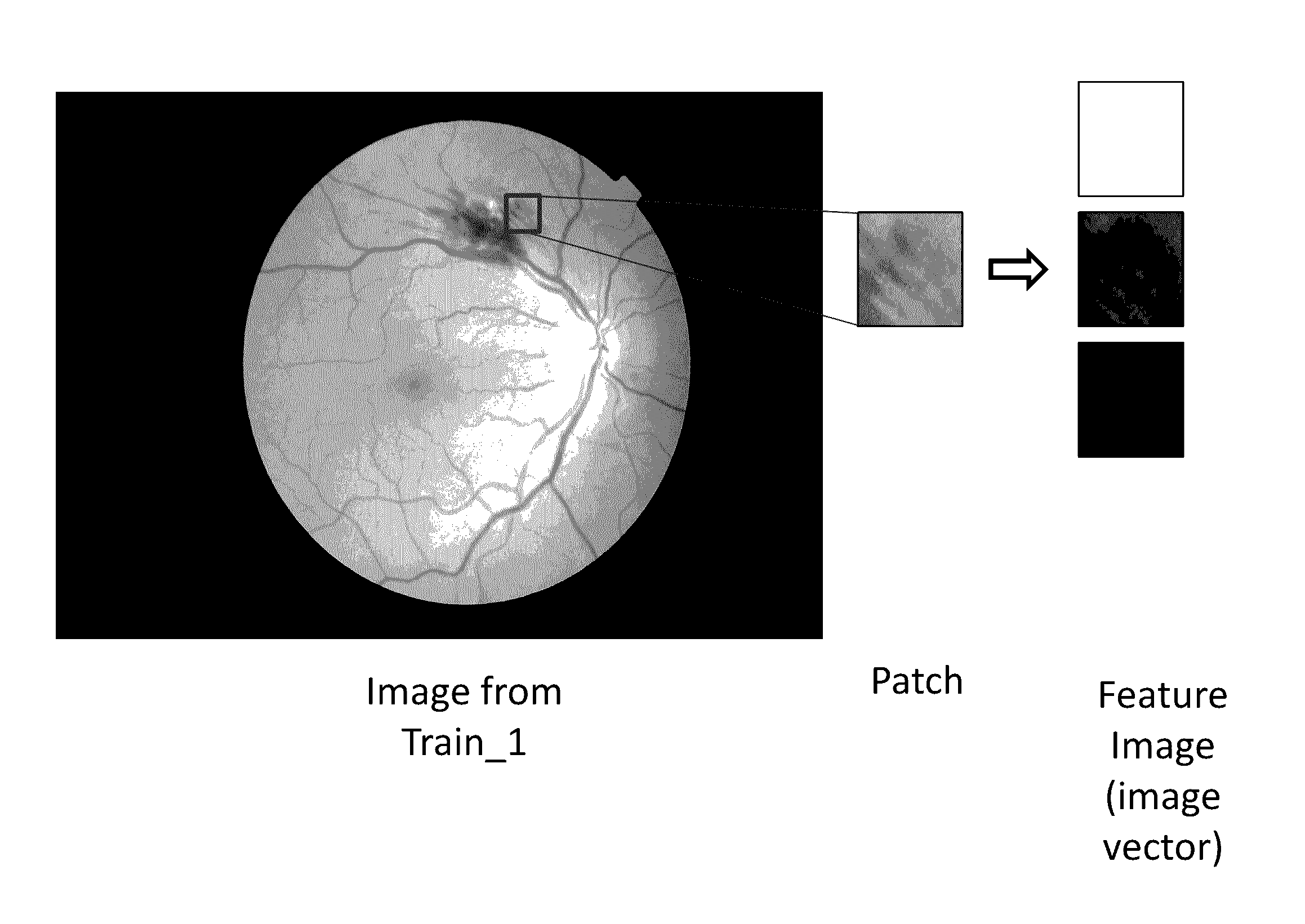 Systems and methods for feature detection in retinal images
