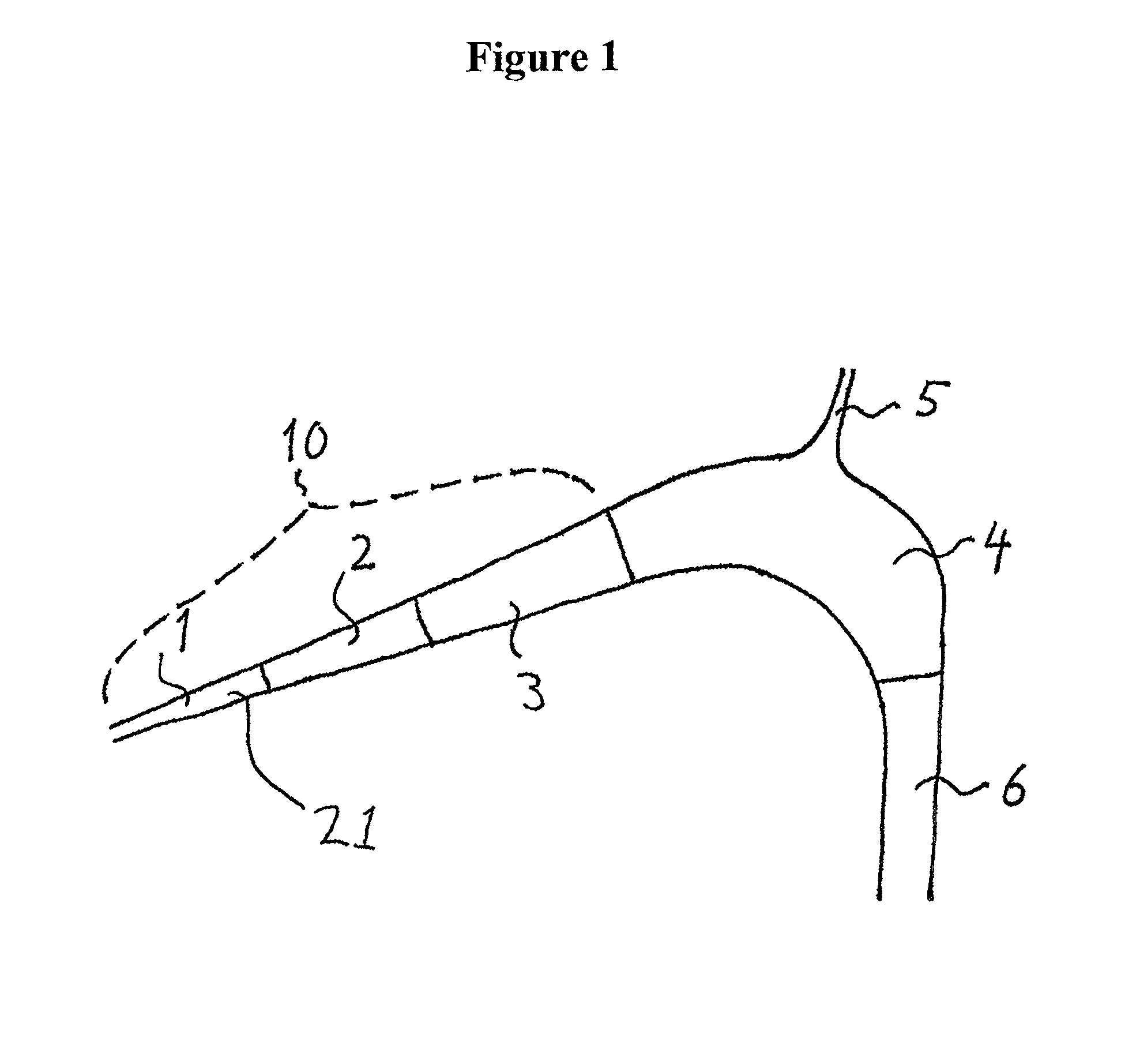 Bubble reducer for eliminating gas bubbles from a flow