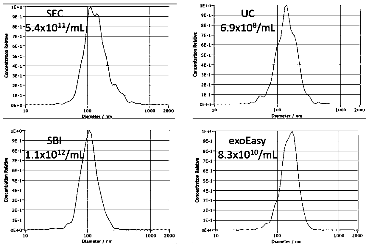 Extracellular vesicle separation and enrichment method based on exclusion chromatography and ultrafiltration technology