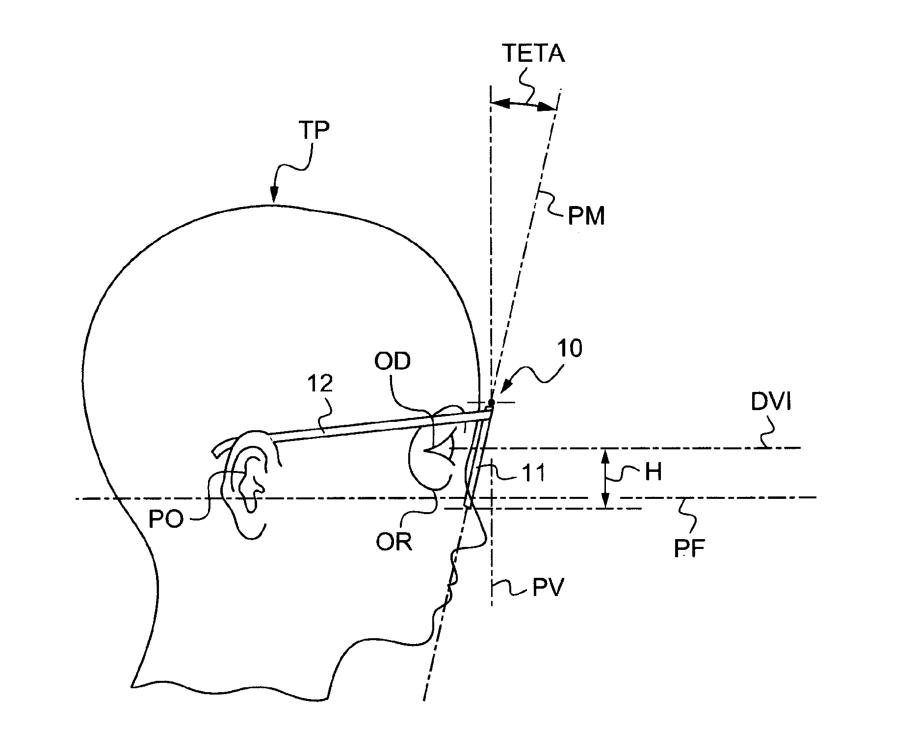 Method of measuring at least one geometrico-physionomic parameter for positioning a frame of vision-correcting eyeglasses on the face of a wearer