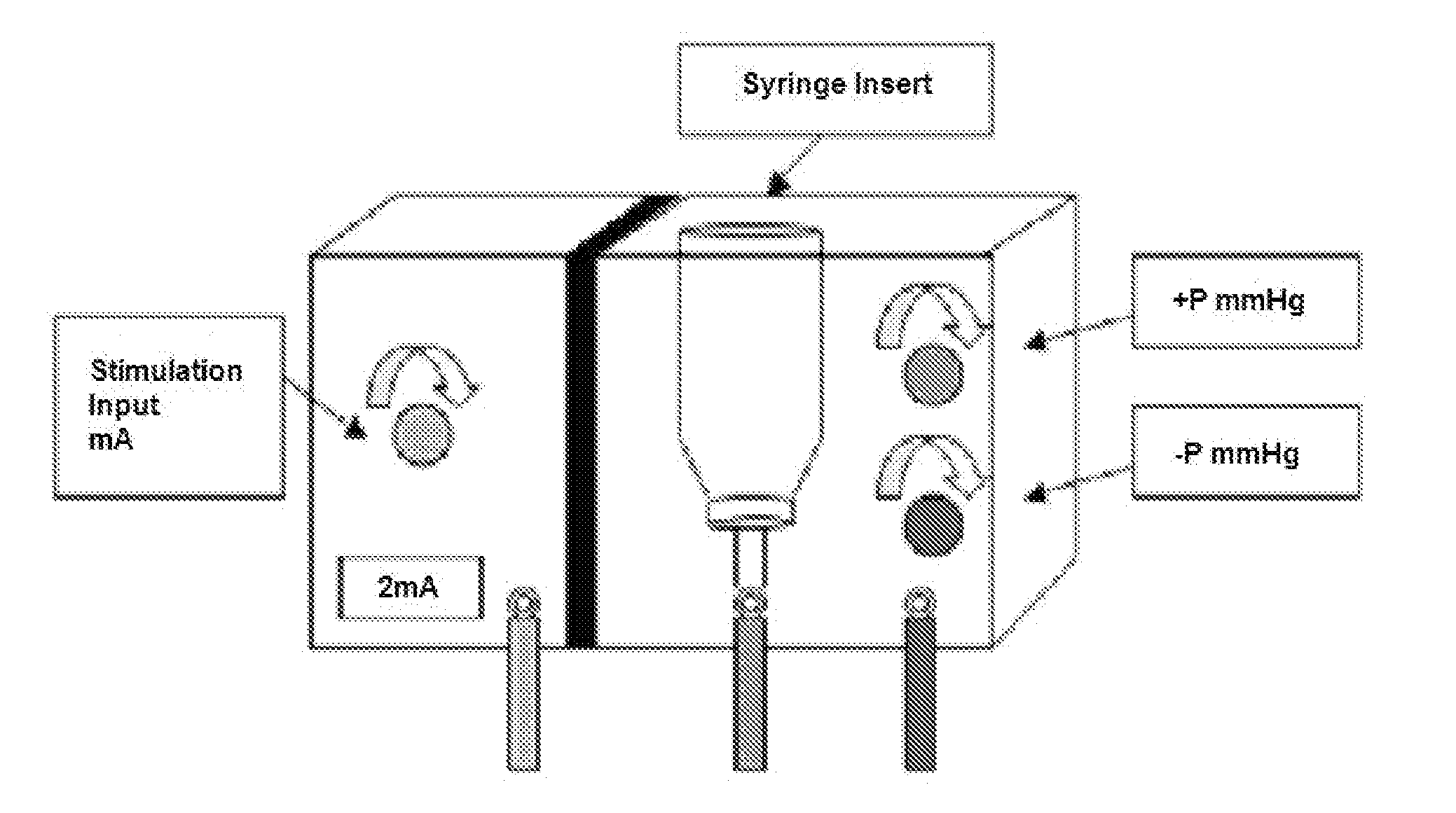 Single operator anesthesia and drug delivery system