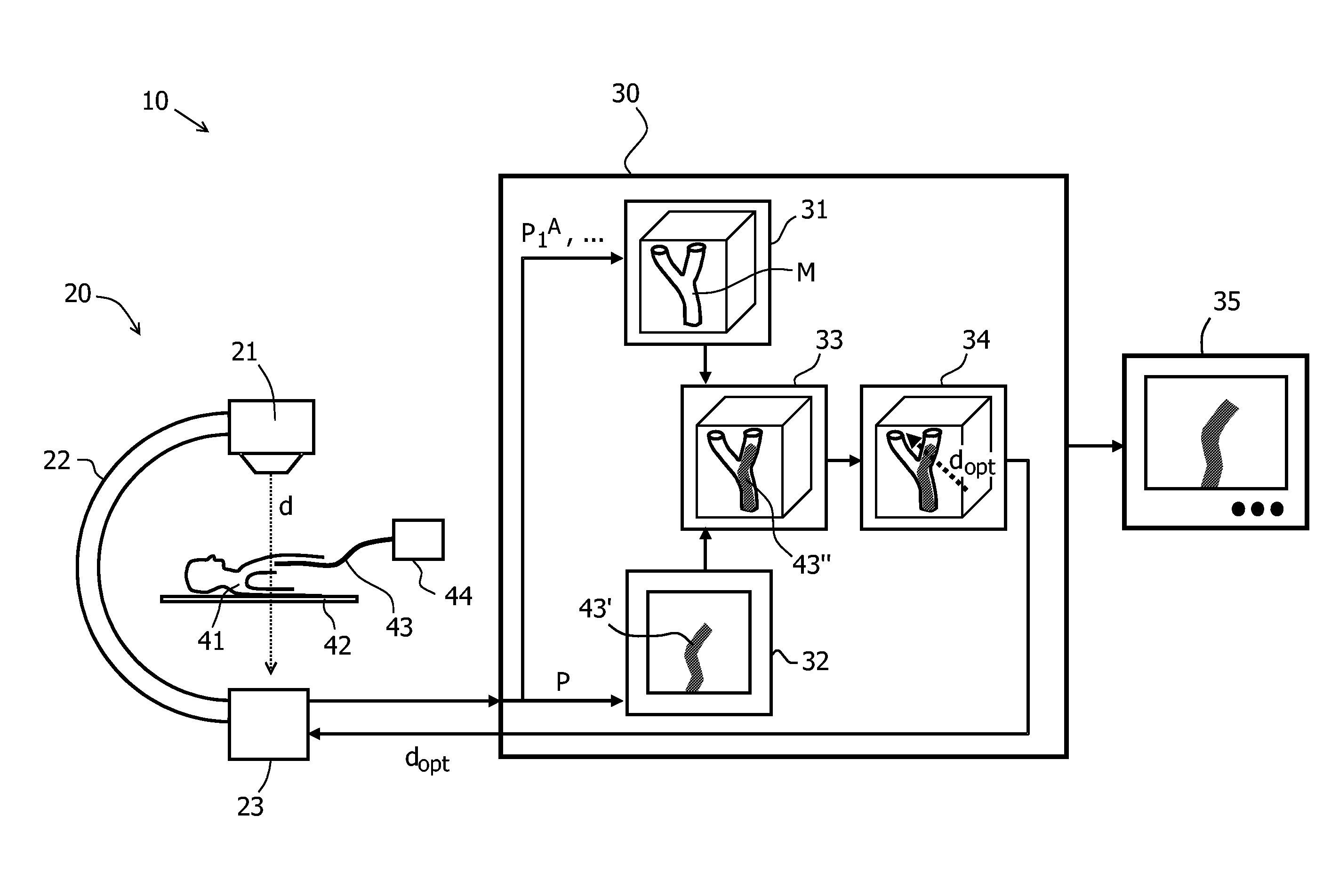 Method And Apparatus For The Observation Of A Catheter A Vessel System