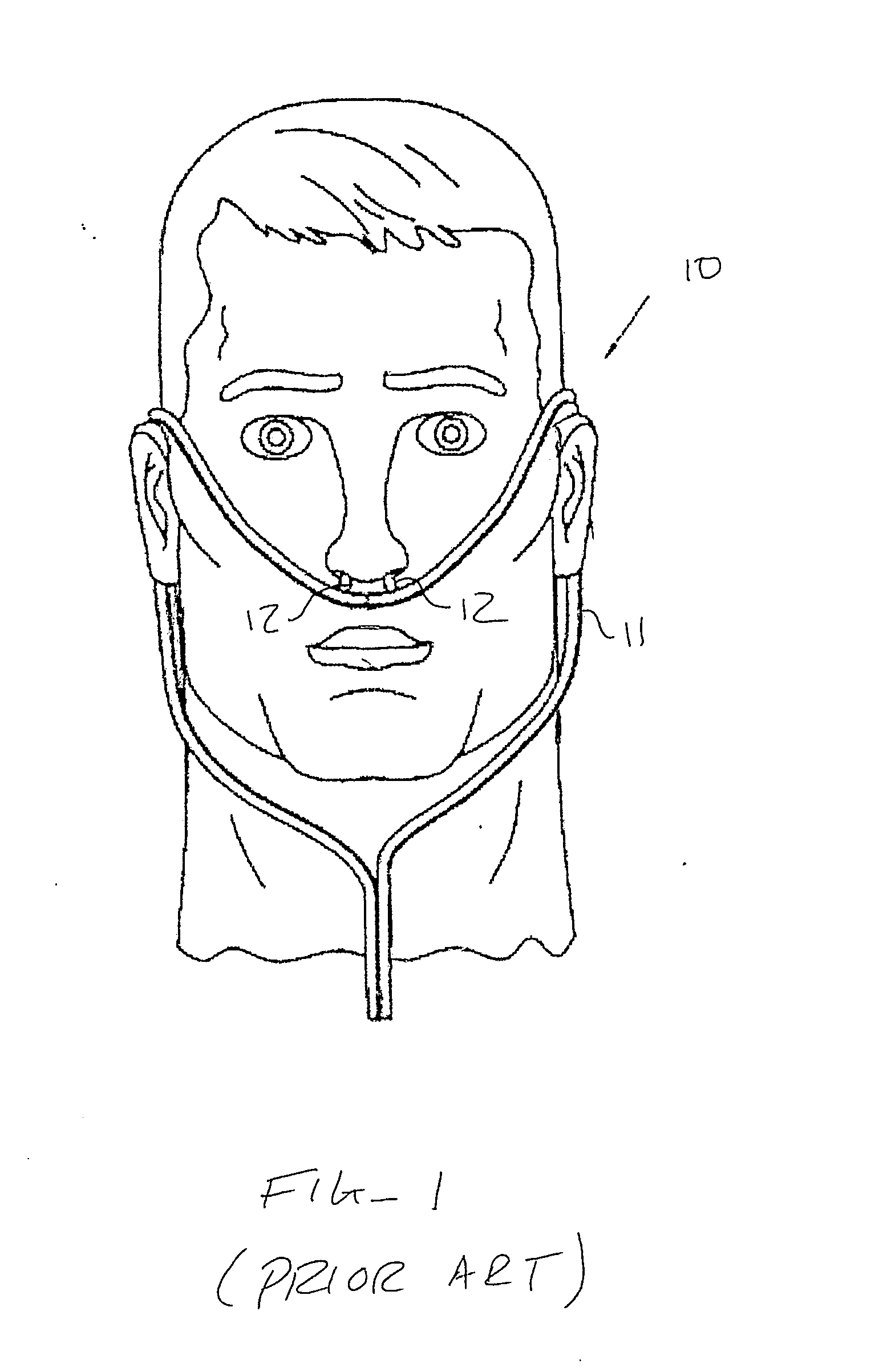 Clip-on nasal air humidifying and epistaxis-prevention device and methods for use with supplemental oxygen