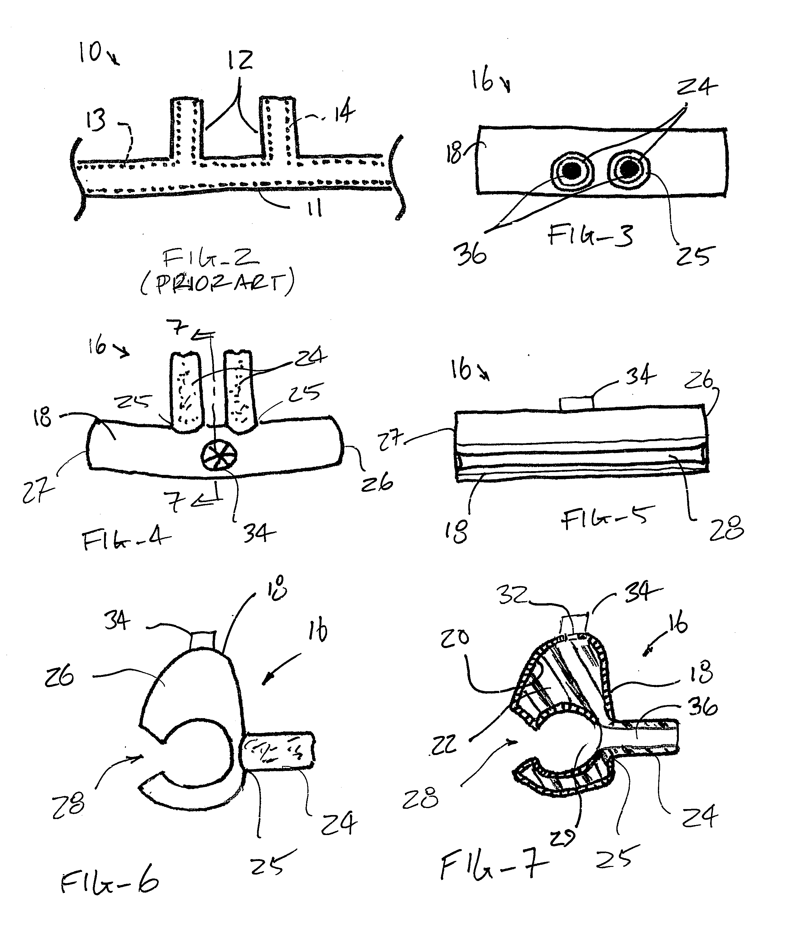 Clip-on nasal air humidifying and epistaxis-prevention device and methods for use with supplemental oxygen