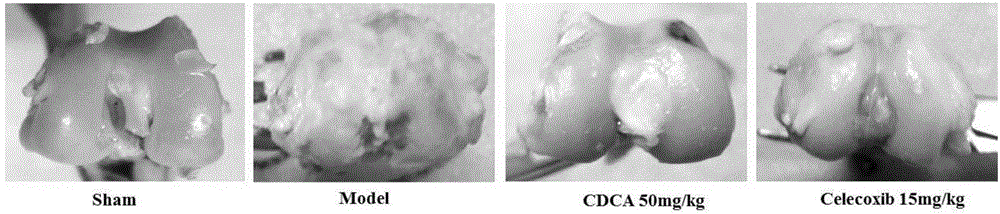 Application of CDCA in preparation of drug for treating osteoarthritis