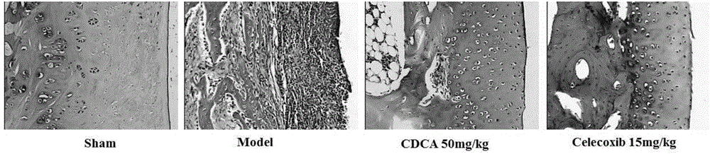 Application of CDCA in preparation of drug for treating osteoarthritis