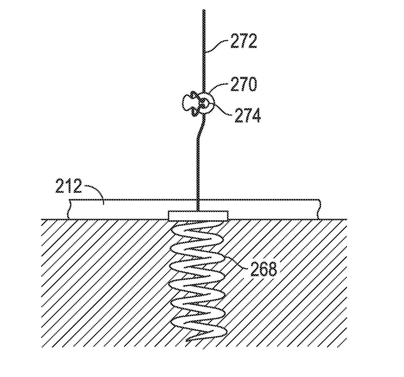 Systems and methods for anchoring an implant