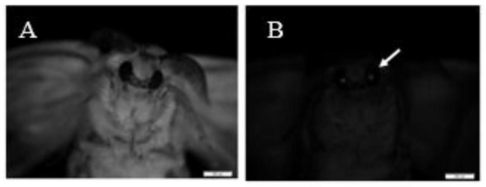 Modified human lactoferrin gene suitable for expression in silk gland of silkworm and its expression system and application