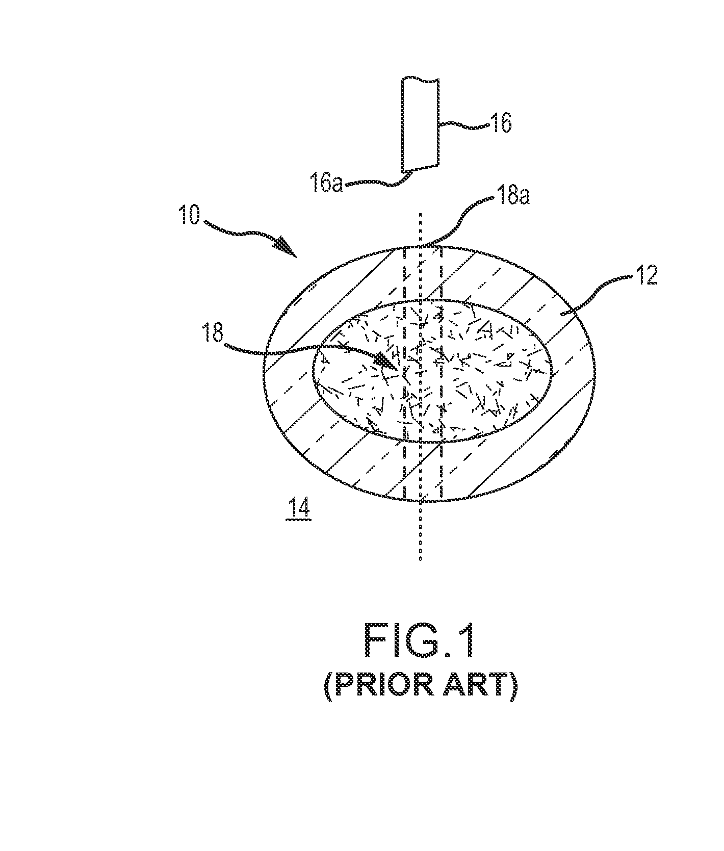 Surgical saw with sensing technology for determining cut through of bone and depth of the saw blade during surgery