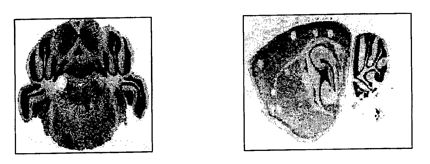 Methods and compositions for treating neuronal damage and modulating transient receptor potential channels