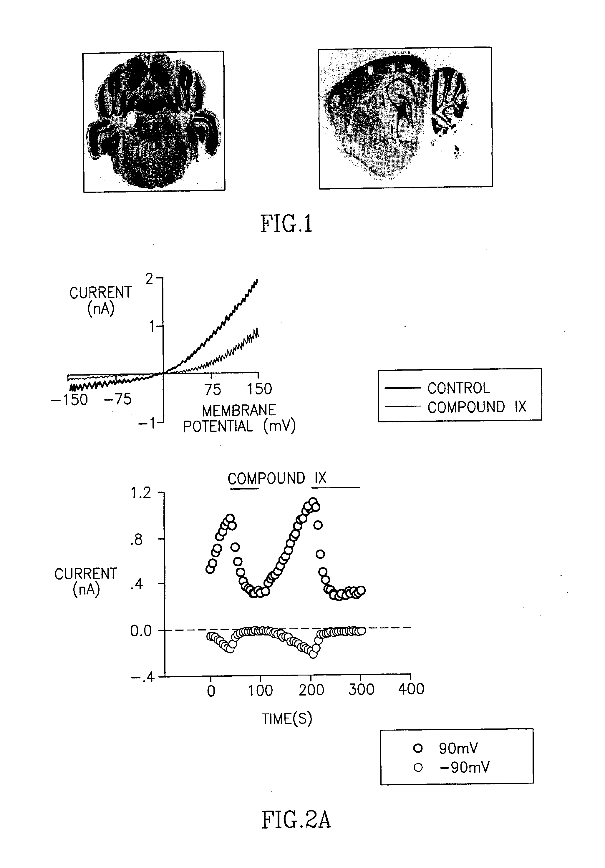 Methods and compositions for treating neuronal damage and modulating transient receptor potential channels