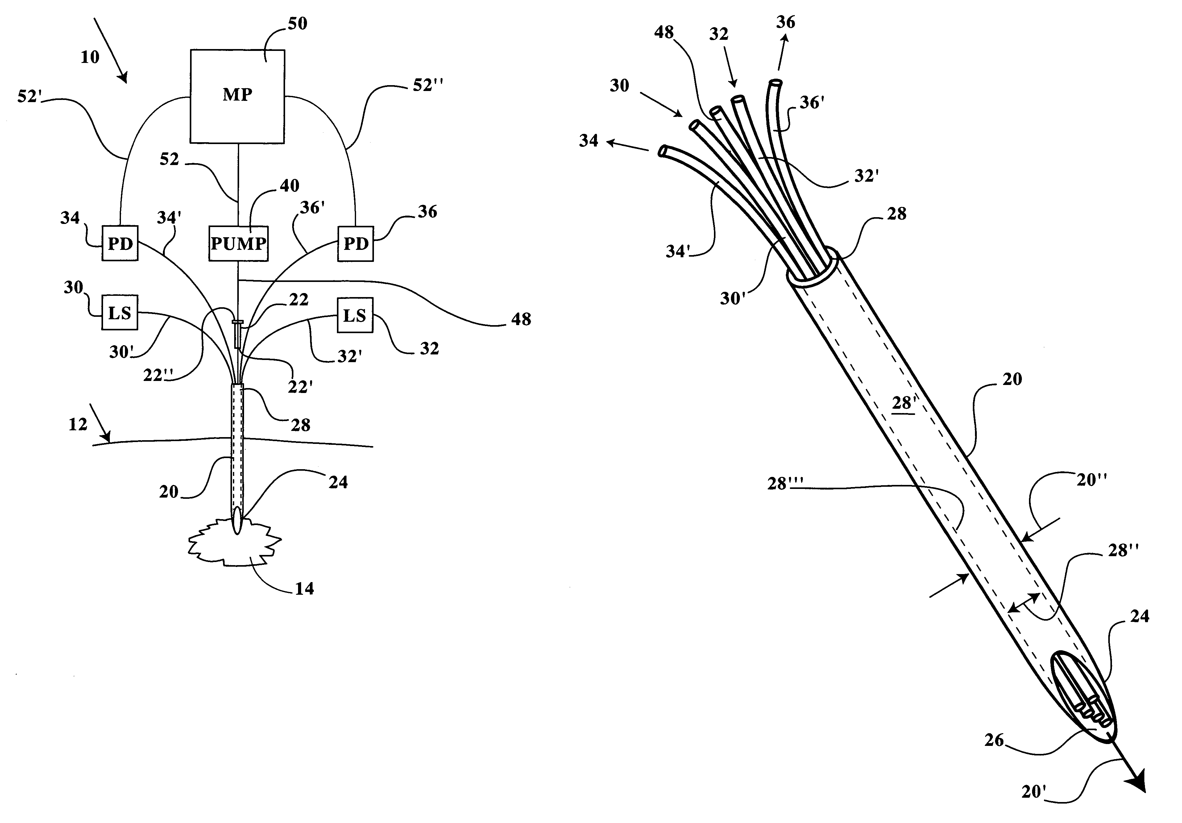 Precision sensing and treatment delivery device for promoting healing in living tissue