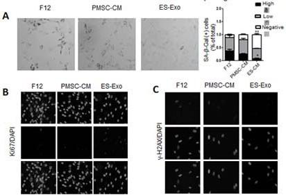 Stem cell-derived exosome preparation with function of delaying senescence