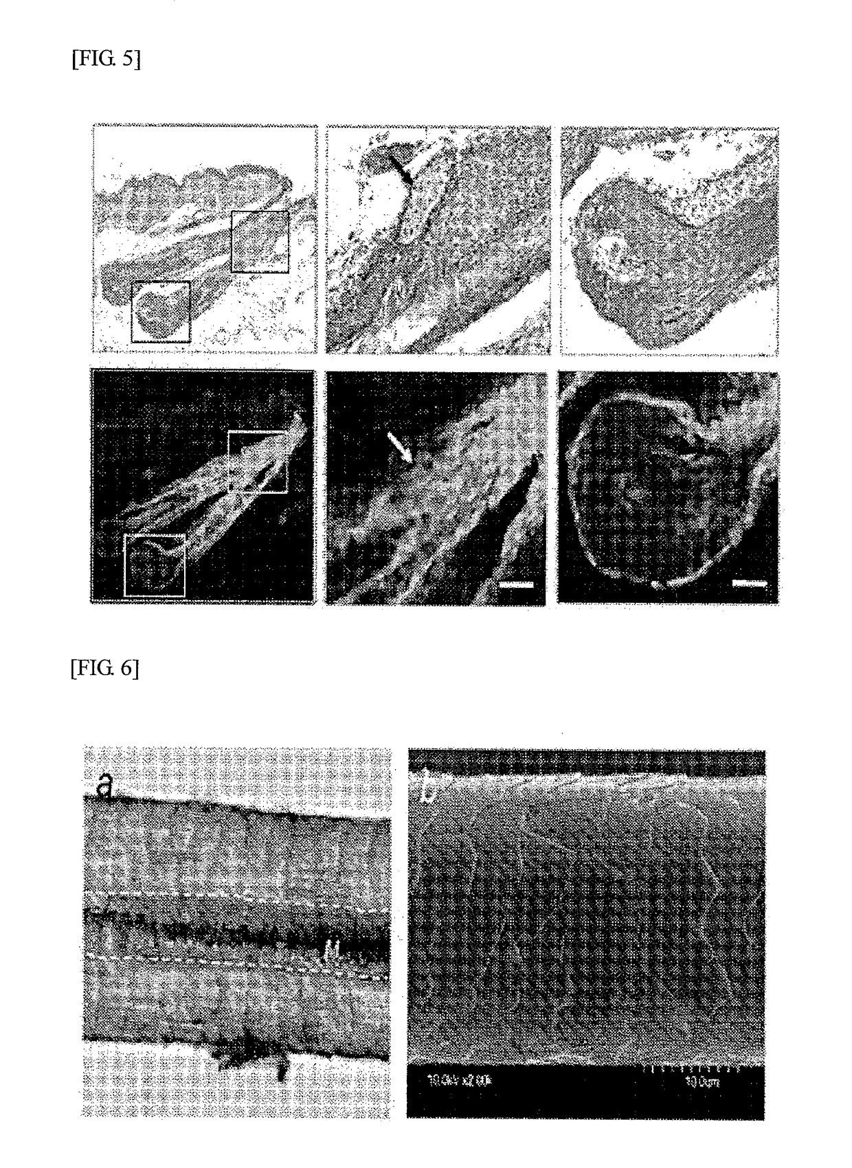 Method for producing regenerative organ primordium provided with guide for transplantation, composition containing regenerative organ primordium provided with guide for transplantation produced thereby, and method for transplanting regenerative organ primordium provided with guide for transplantation