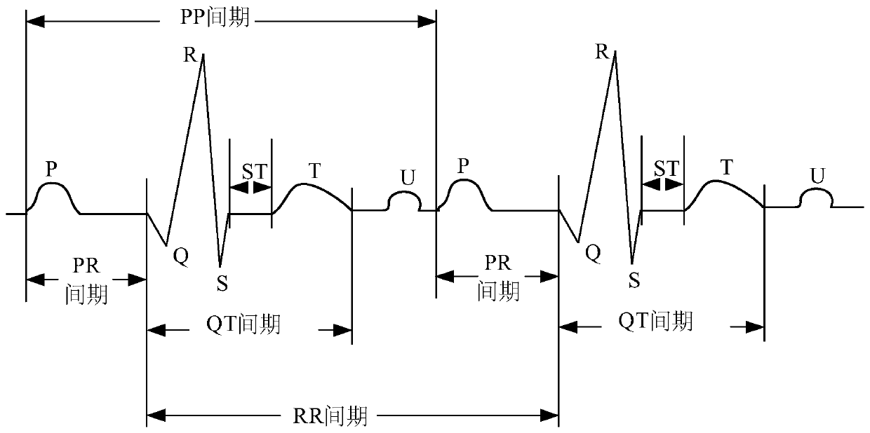 Electrocardio analysis method and device based on picture and heart beat information, equipment and medium