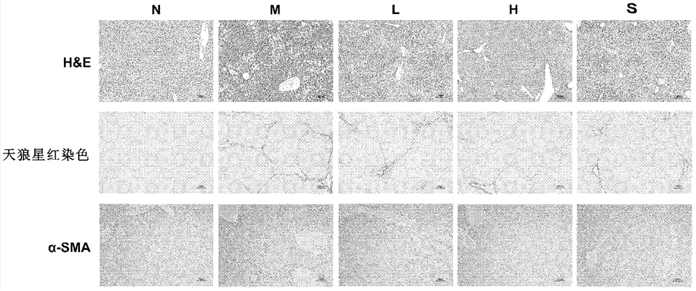 Application of pyrroloquinoline quinone in treatment and/or prevention of liver fibrosis