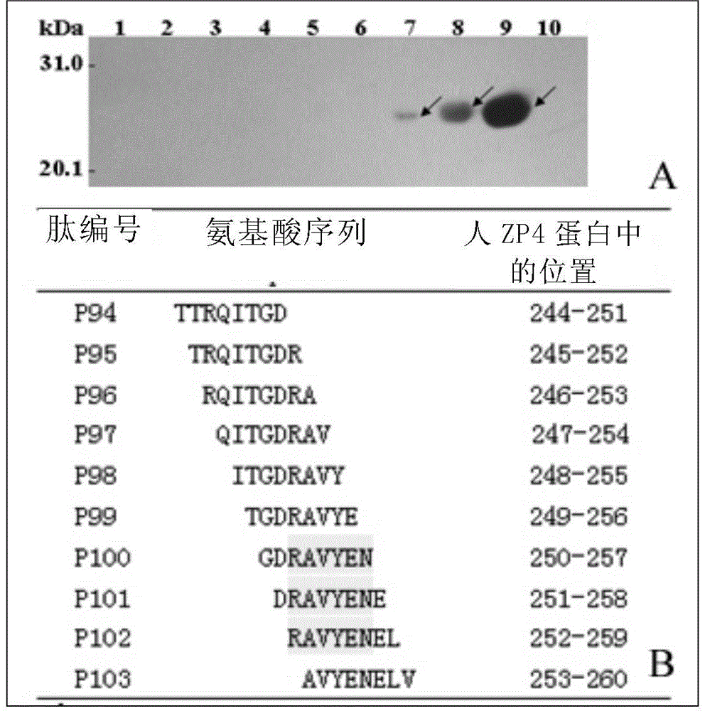 Epitope peptide in human egg zona pellucida protein 4 and its application