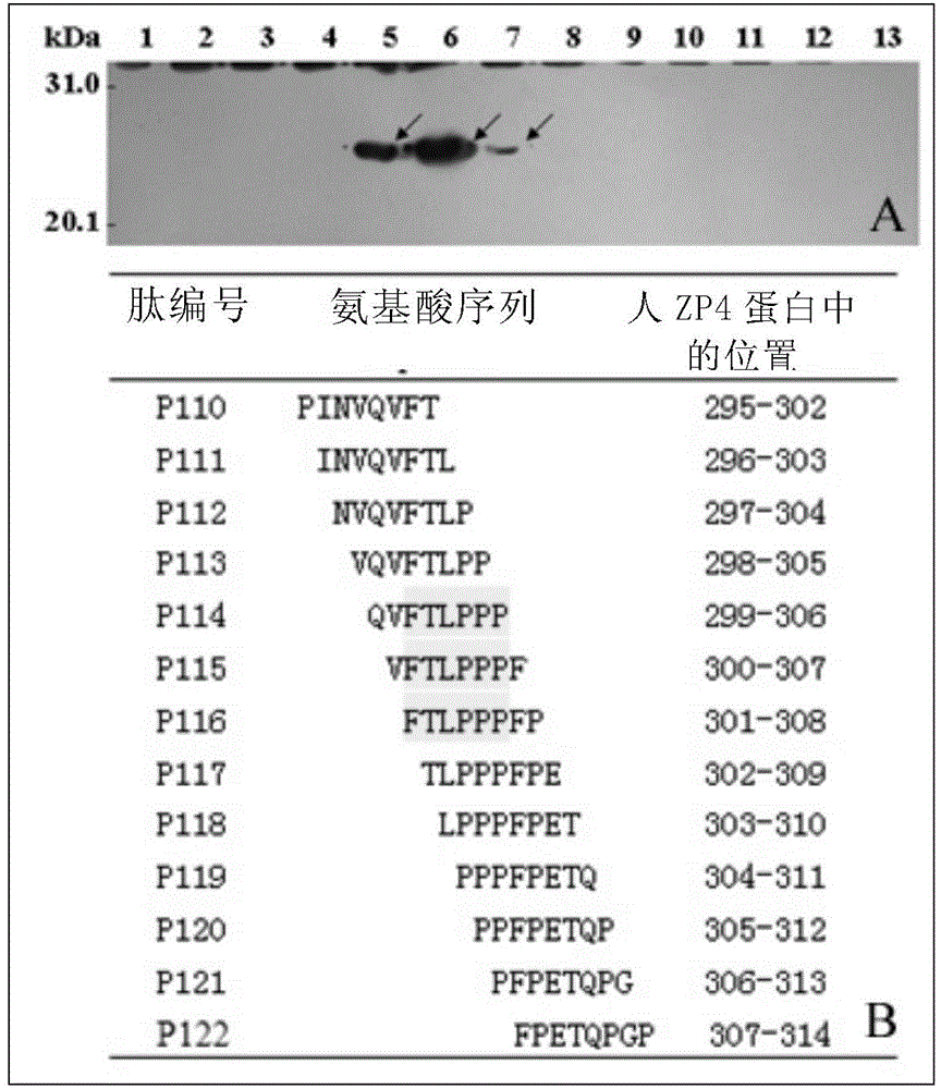 Epitope peptide in human egg zona pellucida protein 4 and its application