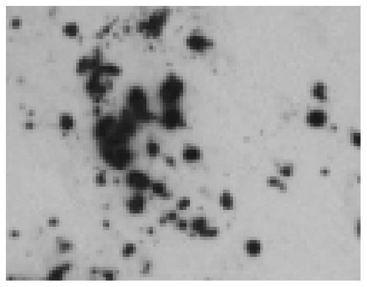 Culture medium and culture method for mesenchymal stem cells